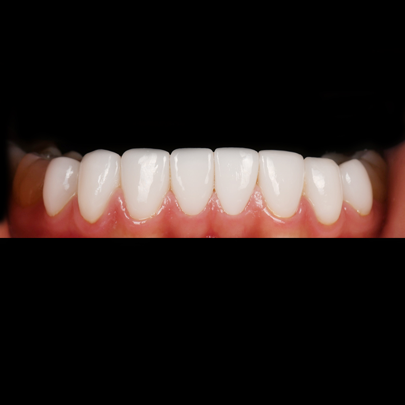After