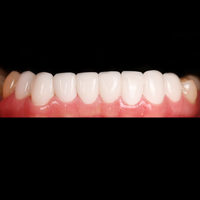 After
