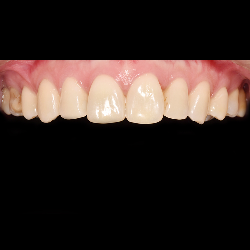Before