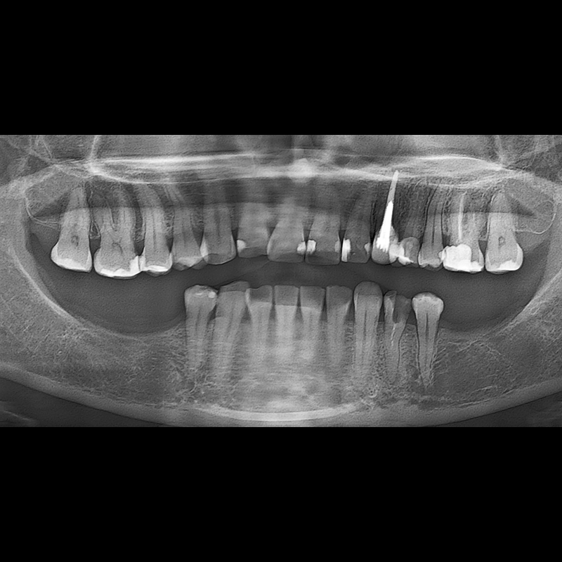 Before